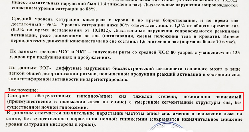 Пример из практики.  Лечение тяжелой формы апноэ без удаления аденоидов